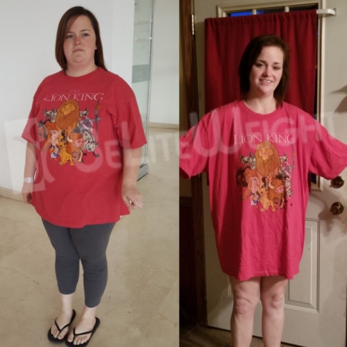 Victoria - 4 years after Gastric Sleeve Update*